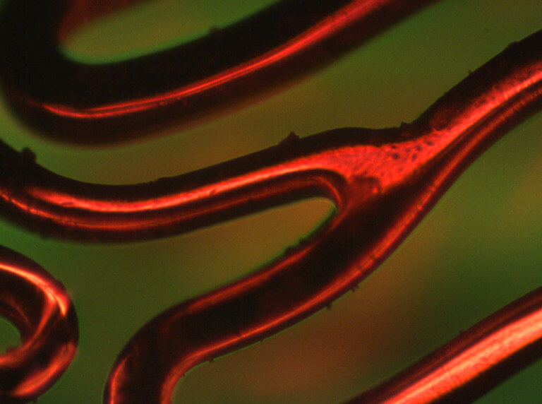 stent under magnification with filter showing burrs