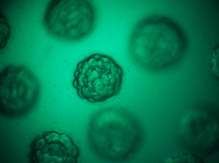 Eggs magnified using EVO Cam II digital microscope