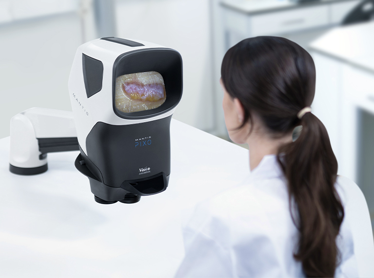 Mantis Elite Cam HD with monitor showing air follicle magnified